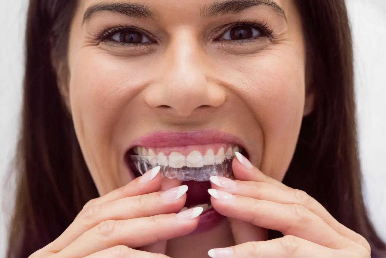 The Invisalign Process: 3 Steps to Straight Teeth
